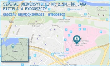ODDZIAŁ NEUROCHIRURGII - SZPITAL UNIWERSYTECKI NR 2 IM. DR JANA BIZIELA W BYDGOSZCZY - UJEJSKIEGO 75,  BYDGOSZCZ
