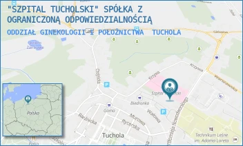 ODDZIAŁ GINEKOLOGII I POŁOŻNICTWA - "SZPITAL TUCHOLSKI" SPÓŁKA Z OGRANICZONĄ ODPOWIEDZIALNOŚCIĄ - NOWODWORSKIEGO 14-18,  TUCHOLA
