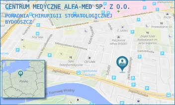 PORADNIA CHIRURIGII STOMATOLOGICZNEJ - CENTRUM MEDYCZNE ALFA-MED SP. Z O.O. - PESTALOZZIEGO 7,  BYDGOSZCZ
