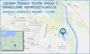 PORADNIA CHIRURGII OGÓLNEJ - CENTRUM ZDROWIA TUCHÓW SPÓŁKA Z OGRANICZONĄ ODPOWIEDZIALNOŚCIĄ - UL. SZPITALNA 1,  TUCHÓW