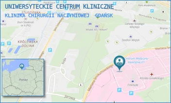KLINIKA CHIRURGII NACZYNIOWEJ - UNIWERSYTECKIE CENTRUM KLINICZNE - UL. MARIANA SMOLUCHOWSKIEGO 17,  GDAŃSK