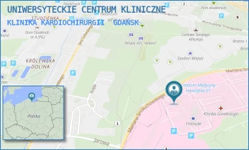 KLINIKA KARDIOCHIRURGII - UNIWERSYTECKIE CENTRUM KLINICZNE - UL. MARIANA SMOLUCHOWSKIEGO 17,  GDAŃSK