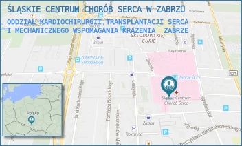 ODDZIAŁ KARDIOCHIRURGII,TRANSPLANTACJI SERCA I MECHANICZNEGO WSPOMAGANIA KRĄŻENIA - ŚLĄSKIE CENTRUM CHORÓB SERCA W ZABRZU - UL. MARII CURIE-SKŁODOWSKIEJ 9,  ZABRZE
