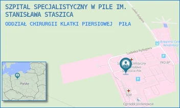ODDZIAŁ CHIRURGII KLATKI PIERSIOWEJ - SZPITAL SPECJALISTYCZNY W PILE IM. STANISŁAWA STASZICA - RYDYGIERA 1,  PIŁA