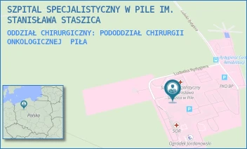 ODDZIAŁ CHIRURGICZNY: PODODDZIAŁ CHIRURGII ONKOLOGICZNEJ - SZPITAL SPECJALISTYCZNY W PILE IM. STANISŁAWA STASZICA - RYDYGIERA 1,  PIŁA