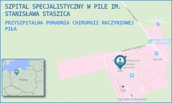 PRZYSZPITALNA PORADNIA CHIRURGII NACZYNIOWEJ - SZPITAL SPECJALISTYCZNY W PILE IM. STANISŁAWA STASZICA - RYDYGIERA 1,  PIŁA