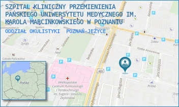 ODDZIAŁ OKULISTYKI - SZPITAL KLINICZNY PRZEMIENIENIA PAŃSKIEGO UNIWERSYTETU MEDYCZNEGO IM. KAROLA MARCINKOWSKIEGO W POZNANIU - AUGUSTYNA SZAMARZEWSKIEGO 84,  POZNAŃ-JEŻYCE