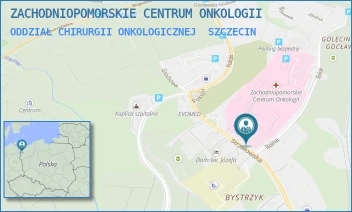 ODDZIAŁ CHIRURGII ONKOLOGICZNEJ - ZACHODNIOPOMORSKIE CENTRUM ONKOLOGII - STRZAŁOWSKA 22,  SZCZECIN